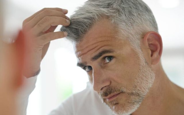 علت سفید شدن مو در سنین پایین چیست؟