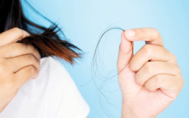 عادت‌ها و مواد غذایی مفید برای کاهش ریزش مو