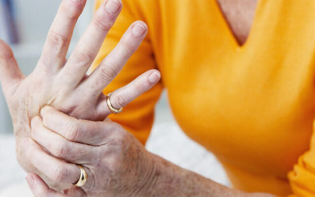 احتمال آرتروز انگشتان دست در چه کسانی بیشتر است؟ | ساییدگی شست دست زنان ۳۰ درصد بیشتر از مردان