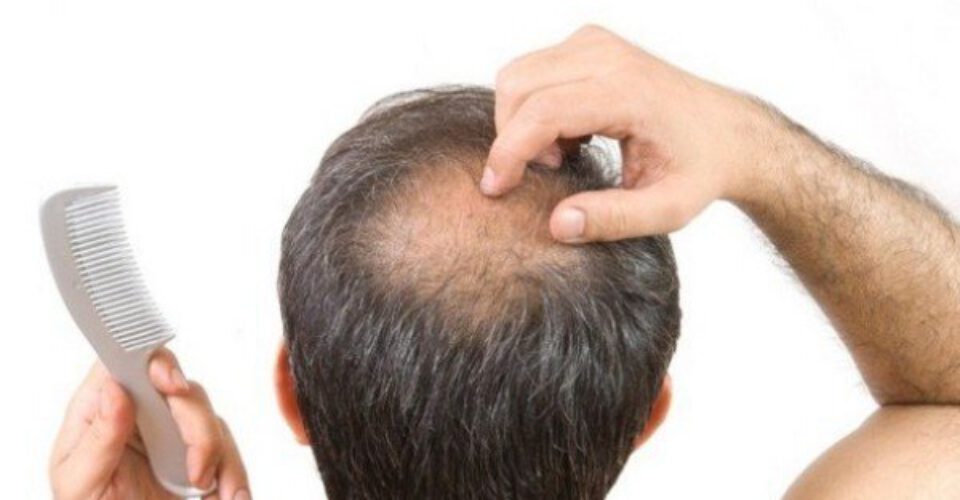 در تله کندن مو گرفتار نشوید