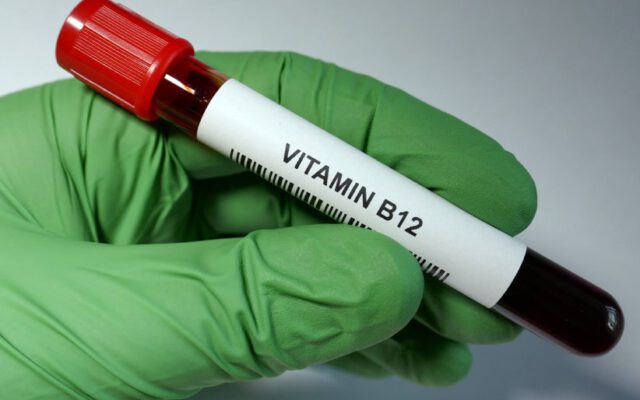 ۱۳ مورد از علائم کمبود ویتامین B12 که باید بشناسید