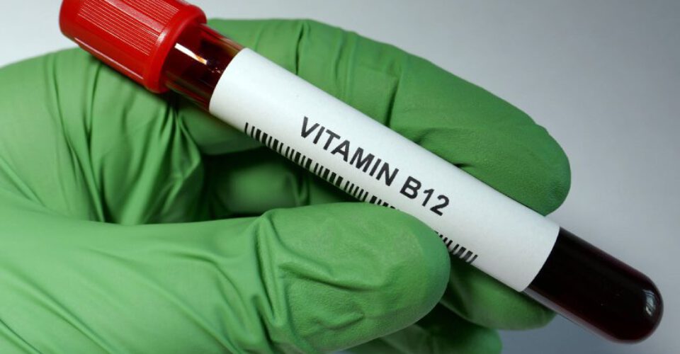 ۱۳ مورد از علائم کمبود ویتامین B12 که باید بشناسید
