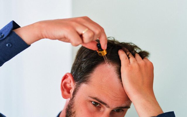 لوسیون مو چیست؛ آیا استفاده از آن تأثیری در بهبود وضعیت مو دارد؟