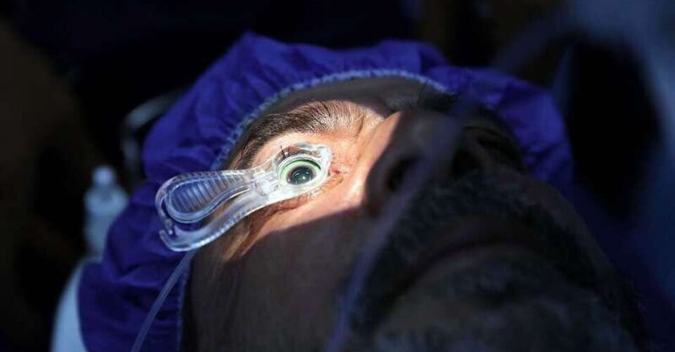 هشدار درباره خطرات عمل تغییر رنگ چشم برای افراد سالم