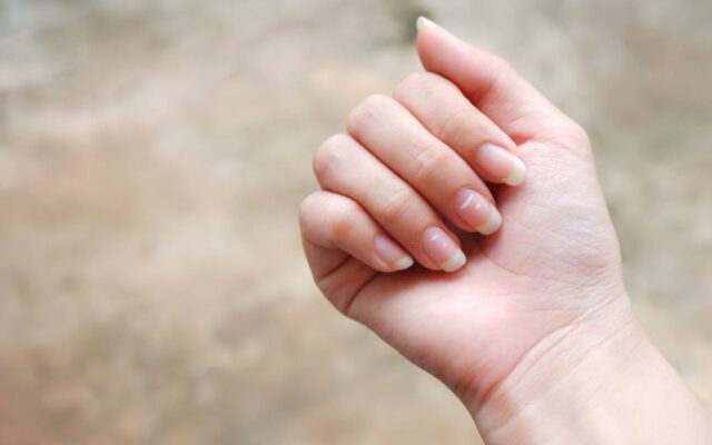۸ علت به وجود آمدن لکه‌ی سفید روی ناخن که بهتر است بدانید