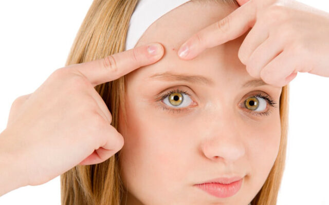 مشاوره درمان جوش صورت