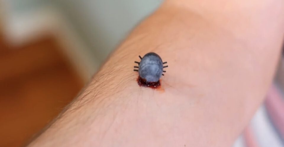 حشراتی که میتوانند روی پوست بدن و سر انسان زندگی کنند