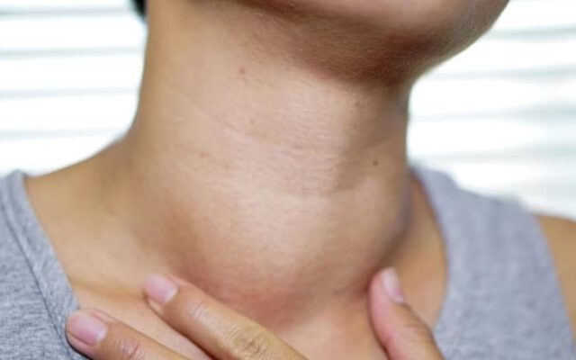 علائم پوستی تیروئید چیست؟