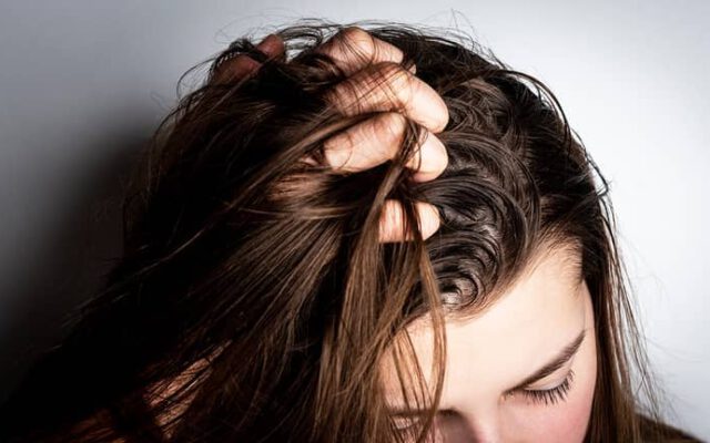 علت و درمان چربی مو و کف سر
