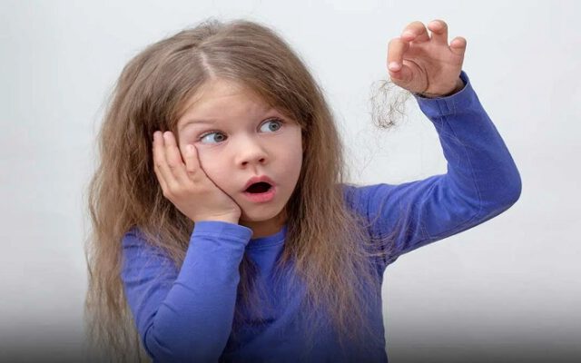 ریزش مو در کودکان؛ علت و درمان