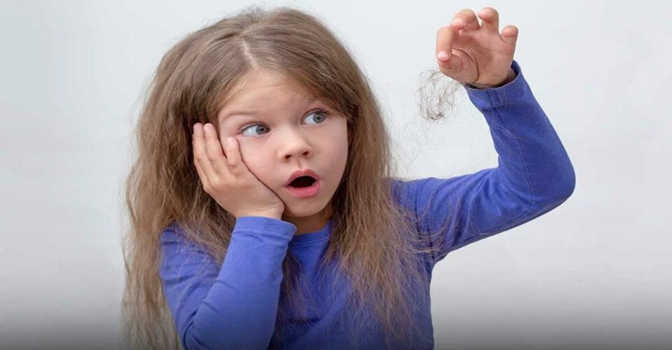 ریزش مو در کودکان؛ علت و درمان