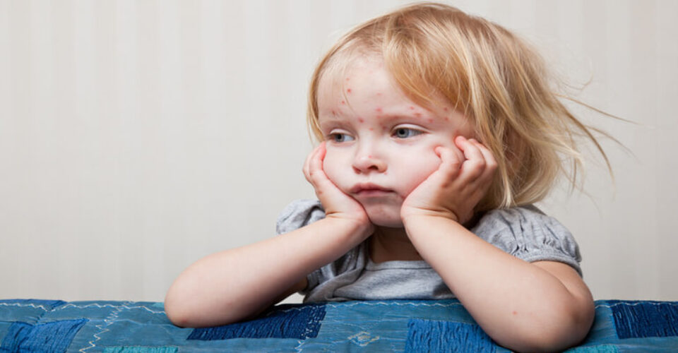 10 دلیل موثر بر حساسیت پوستی کودکان
