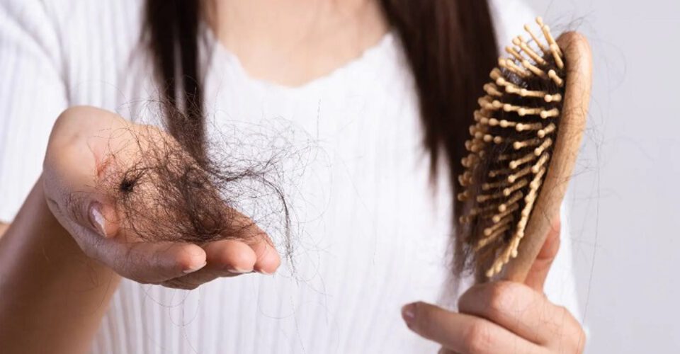 چه بیماری هایی باعث ریزش مو می شوند؟