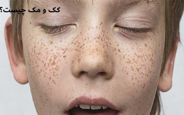 کک و مک چیست؟