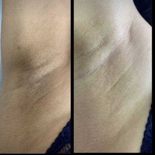 کلینیک لیزر و پوست و مو فهیمه کمال زاده(دکترعطیه فیاضی)