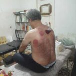 حجامت ماساژ زالو فصد بادکش دیسک سیاتیک دررفتگی مفاصل زردی گوش افتادگی ناف و مثانه