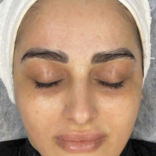 فیشال و پاکسازی آقایان و خانم ها