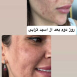 فیشال و پاکسازی آقایان و خانم ها