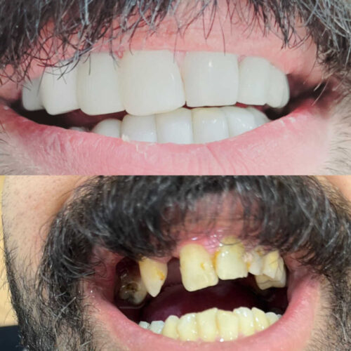 کامپوزیت دندان دندان پزشکی صدف