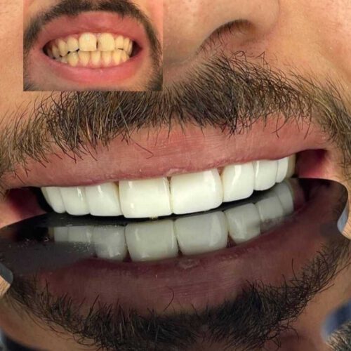 کامپوزیت دندان دندان پزشکی صدف
