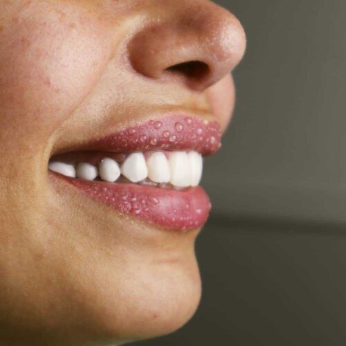 دندانپزشکی دیجیتال آوا