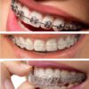 دندانپزشکی دیجیتال آوا