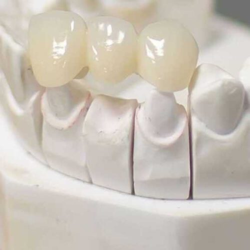 دندانپزشکی دیجیتال آوا